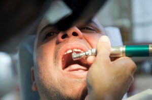 A dentist fixing a patient's broken tooth