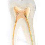 root canal therapy rochester ny